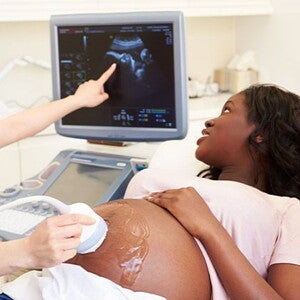 Ultrasonido obstetrico